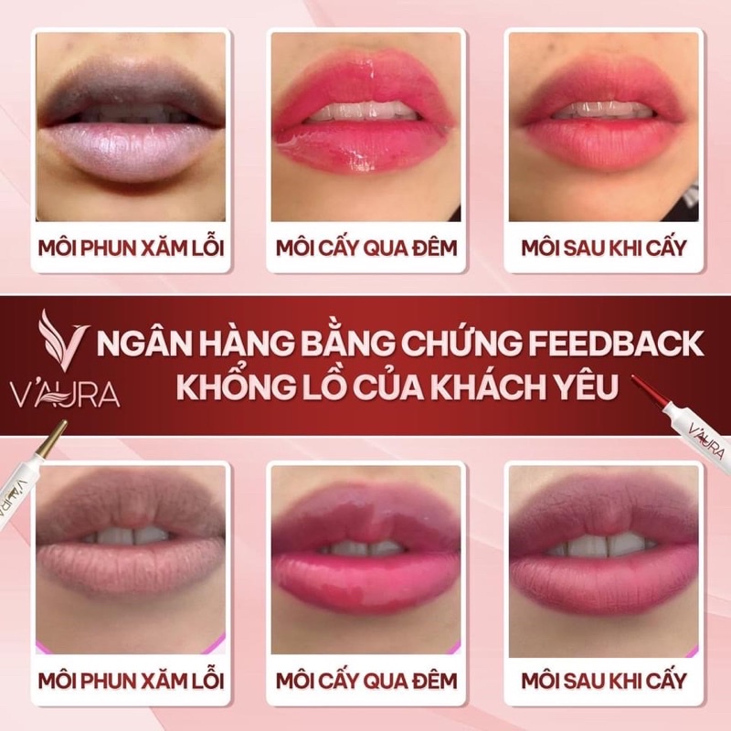 Bộ Tinh Chất Cấy Môi Vaura Babier Lips Volume V3 Master Lips -Khử Thâm Môi -Dưỡng Môi Hồng Vĩnh Viễn – Thay Thế Phun Xăm