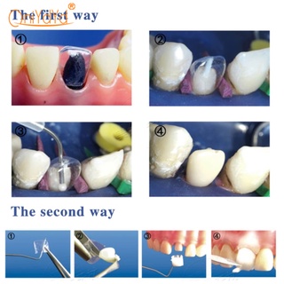 Bộ 64 Vương Miện Bằng Nhựa Trong Suốt Chuyên Dùng Cho Nha Khoa