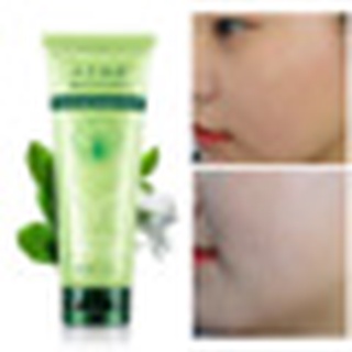 Tẩy Da Chết Lô Hội Trắng Da, Mờ Thâm Xạm ALOE VERA GEL Cao Cấp 100g