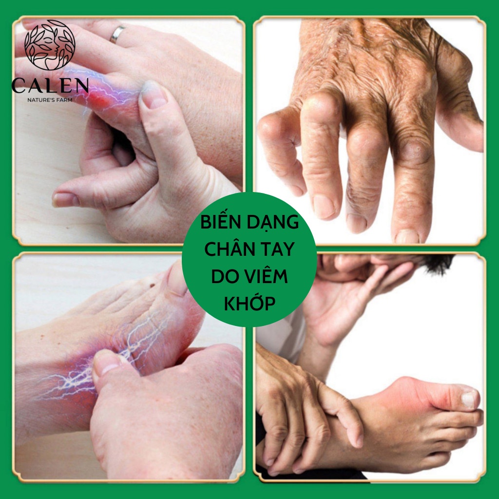 Trà xương khớp CALEN, Hỗ trợ giảm tình trạng về xương khớp, giảm tình trạng nhức mỏi, giúp xương cốt dẻo dai-Bịch 30 gói