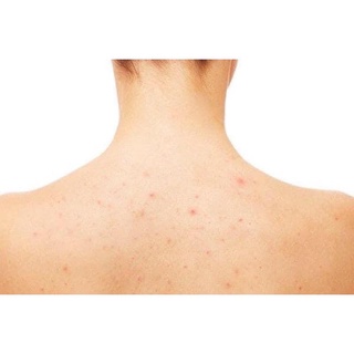 [CHỈ BÁN HÀNG THÁI] LOTION KELLA VIÊM LỖ CHÂN LÔNG,  VIEM DA THÁI LAN