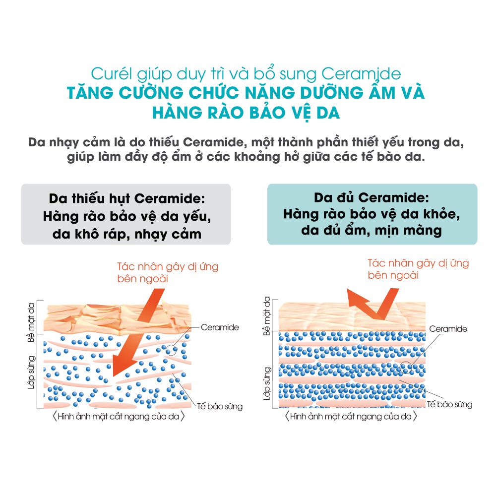 Ảnh Dưỡng môi chuyên sâu Curél Intensive Moisture Care Moisture Lip Care Balm 4.2g 3