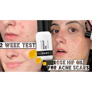 Tinh dầu tầm xuân The INKEY List Rosehip Oil Face Oil 30ml