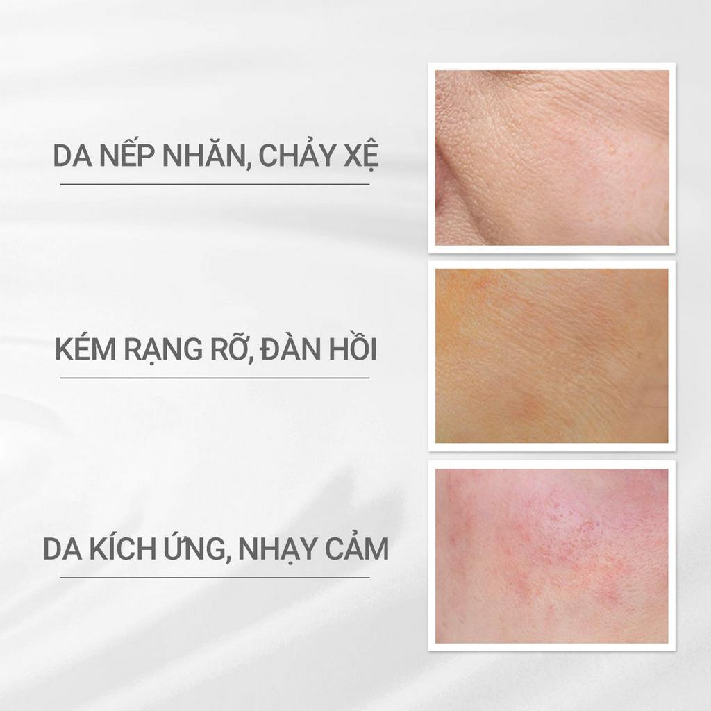 Ảnh Kem dưỡng da ngăn ngừa lão hóa Vitalizing Cream dProgram 45g 2