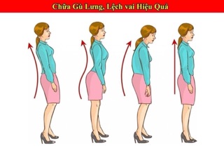 Đai chống gù lưng