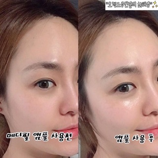 [Medipeel] SERUM VÀ KEM DƯỠNG TRUYỀN TRẮNG MEDI-PEEL GLUTATHIONE