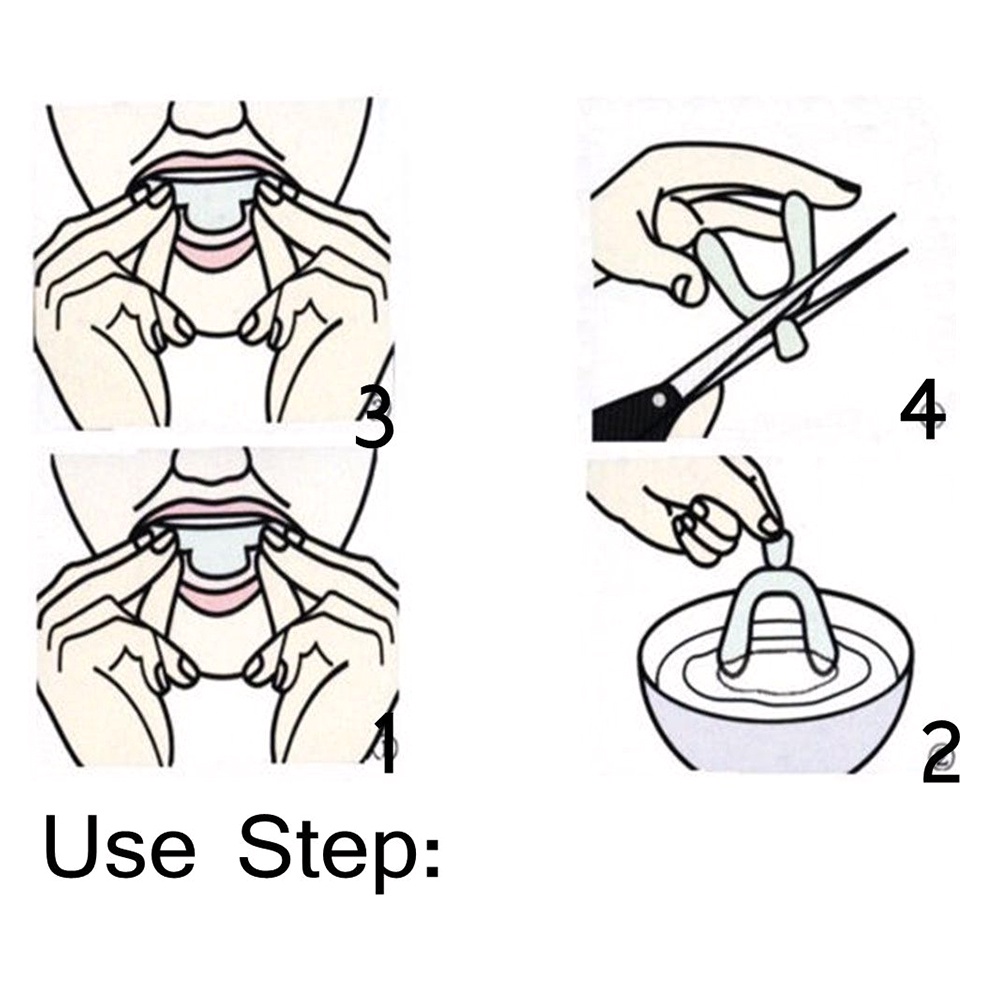 1 Cặp Dụng Cụ Silicone Niềng Răng Tiện Lợi