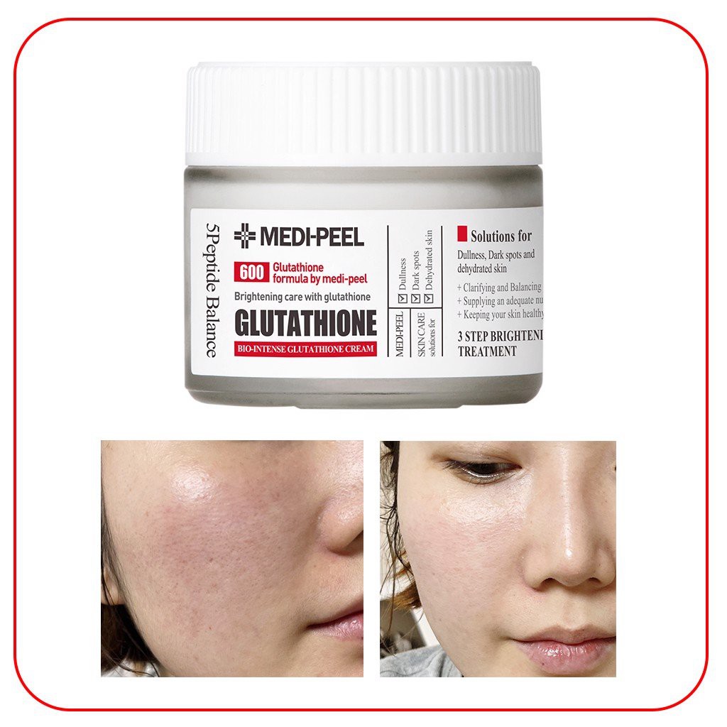 Kem dưỡng trắng Medi Peel Glutathione 600 White Cream hộp 50g - Út store