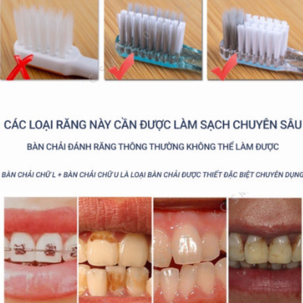 Bàn chải đánh răng cho người niềng răng chữ U và L làm sạch sáng tối, tặng kèm bàn chải kẽ
