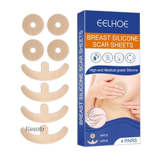 [Kesoto] Tấm silicon Loại bỏ sẹo Tấm giảm ngực nhanh chóng cho Keloid