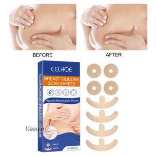 [Kesoto] Tấm silicon Loại bỏ sẹo Tấm giảm ngực nhanh chóng cho Keloid