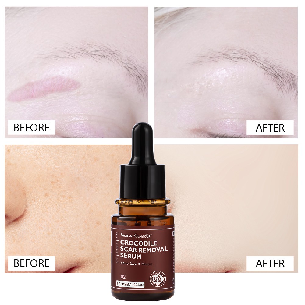 Ảnh Tinh chất xóa sẹo VIBRANT GLAMOUR Sẹo, trị mụn, dưỡng ẩm cho da 30ml 2