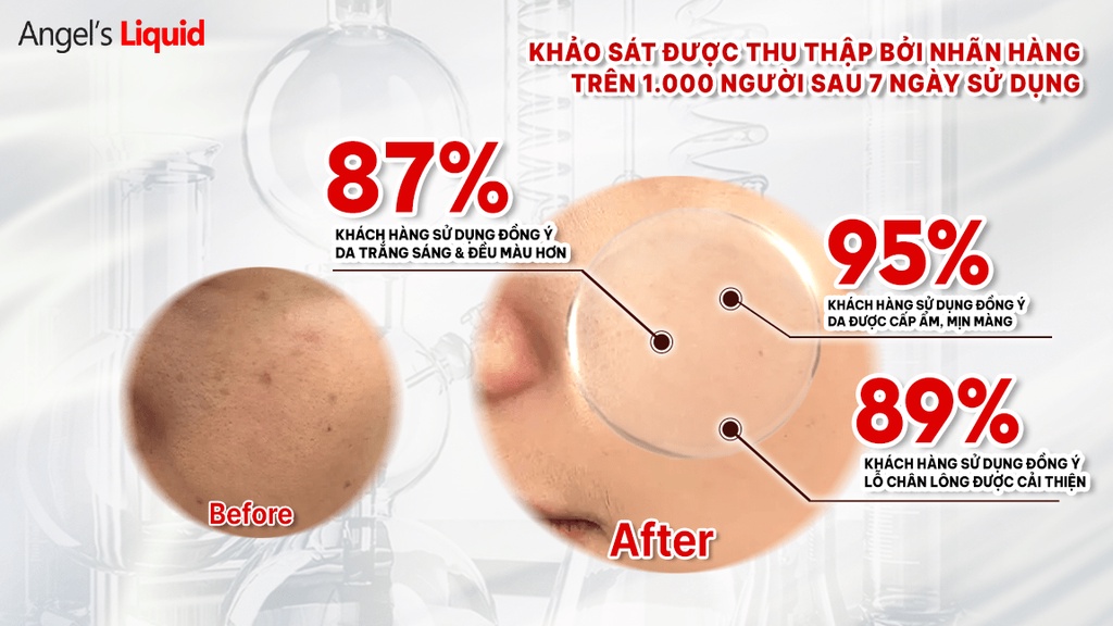 Mô tả Kem Dưỡng Trắng Se Khít Lỗ Chân Lông Angel's Liquid Glutathione +Niacinamide Whitening Cream 50ml - 4