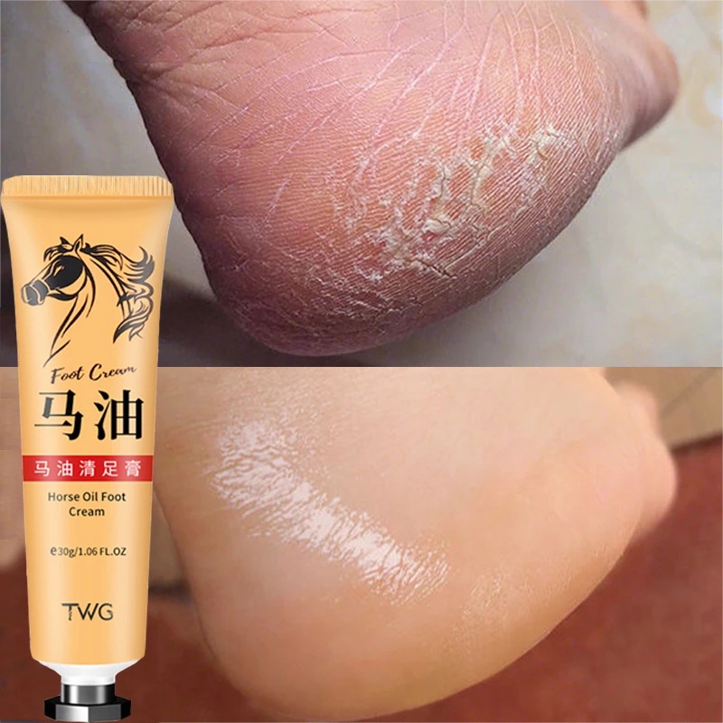 1 Tuýp Kem Dầu Ngựa Trị Nứt Gót Chân Chống Khô Da