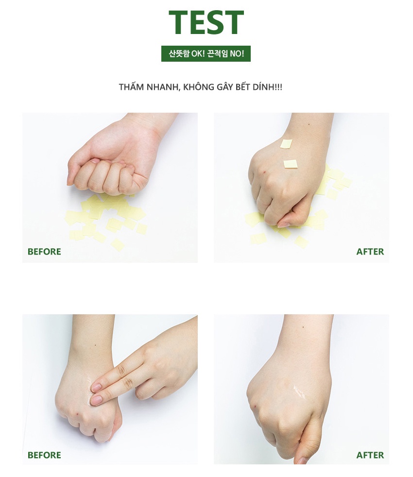 Mô tả Nước hoa hồng PEKAH cải thiện da mụn thu nhỏ lỗ chân lông PEKAH Daily Moisture Peeling Toner 250ml - 4