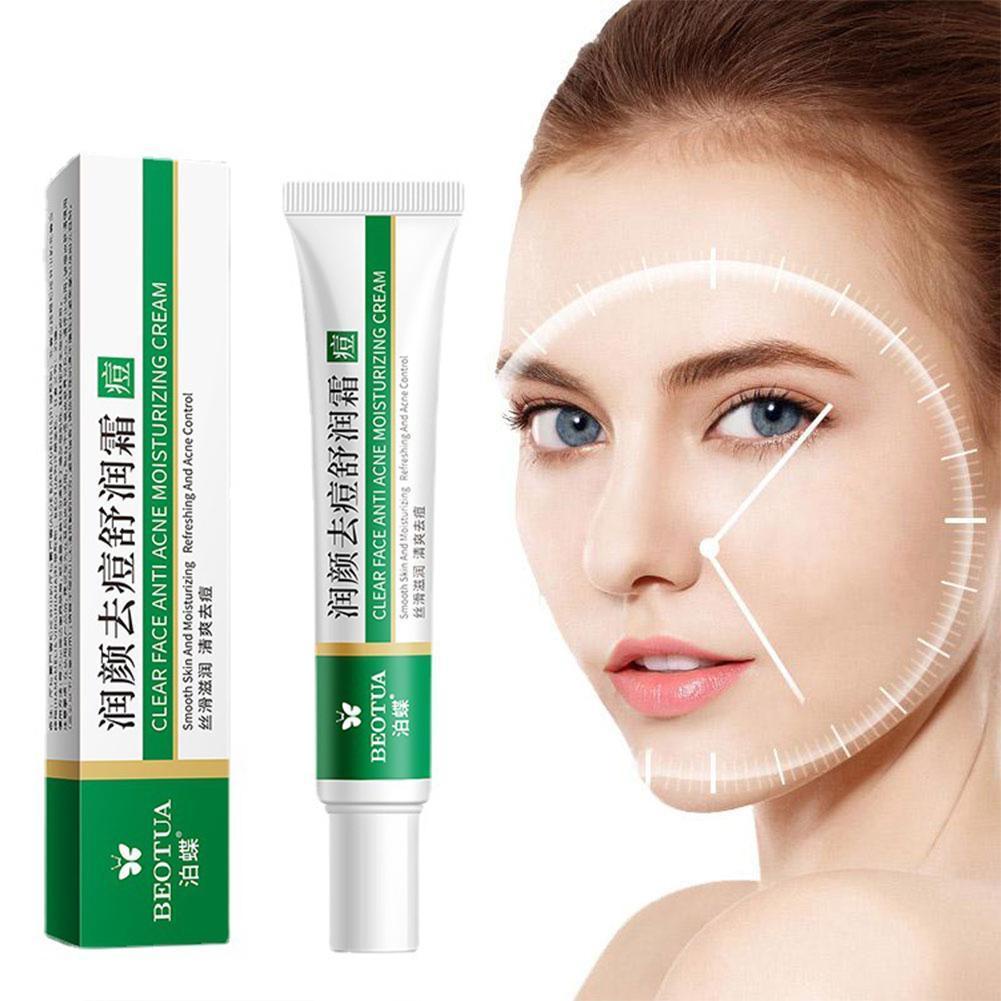 Kem Thảo Dược Hỗ trợ giảm mụn Kiểm Soát Dầu Dưỡng Ẩm Chăm Sóc Da Mặt 20g