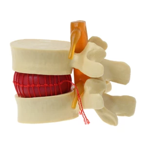 Đạo cụ y tế Yoo Mô hình cột sống Đĩa thoát vị Giải phẫu Công cụ giảng dạy y tế