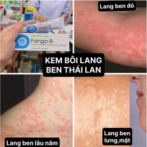 KEM BÔI LANG BEN THÁI LAN [SẴN][FREESHIP][CHUẨN HÀNG][BẢO HÀNH 7 NGÀY]
