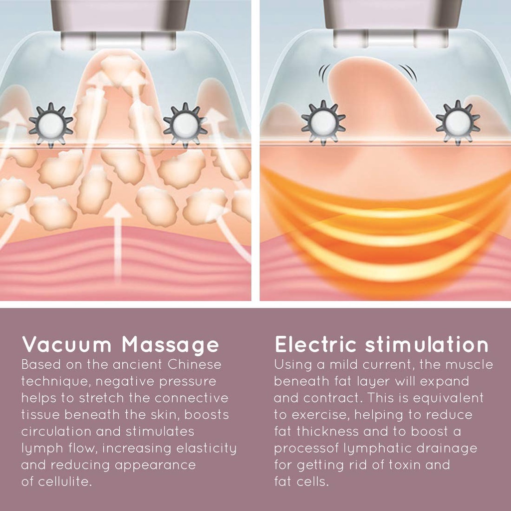 Máy massage giảm mỡ công nghệ hút chân không và EMS cao cấp HoMedics CELL-500-EU