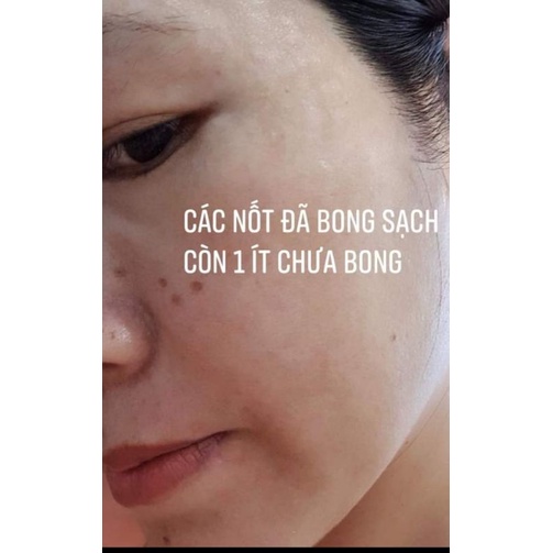 Combo 2 sp tảo sống chấm nám,tàn nhang.