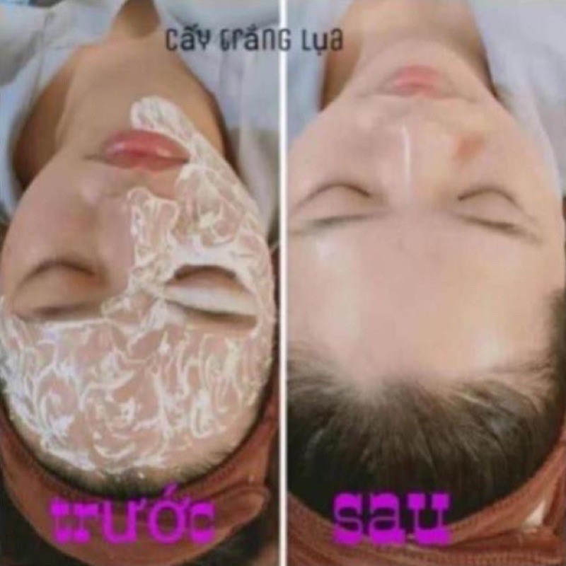 Cấy trắng lụa nguyên hộp