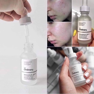 Tinh chất sáng da The ordinary Niacinamide 10% + Zinc 1% (30 ml) giảm dầu, giảm mụn, mờ thâm sau mụn