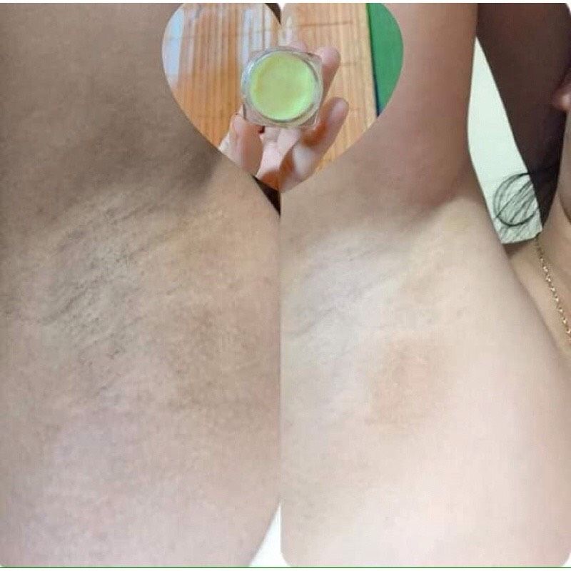 Combo 2 hộp Kem Cô Bơ Khử Thâm Nách Hôi Nách Cô Bơ Dưỡng Trắng - Giảm Mùi Hôi Hiệu Quả