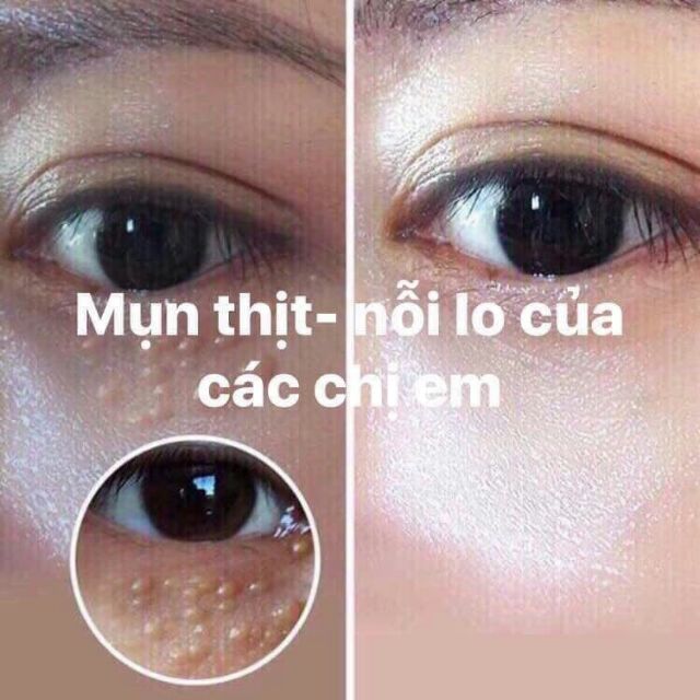 Kem Bôi Trị Mụn Thịt Tsubu Night Pack 30g Nhật Bản