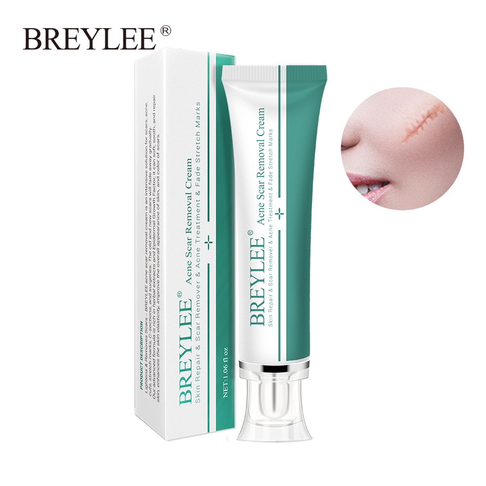 Ảnh Kem xóa sẹo BREYLEE 30g hỗ trợ giảm sẹo mụn xóa vết rạn làm trắng da 4