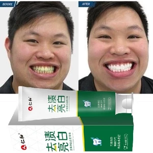 Kem Đánh Trắng Răng Ố Vàng, Kem Đánh Trắng Răng Thơm Miệng, Kem Đánh Răng Ngừa Sâu Răng