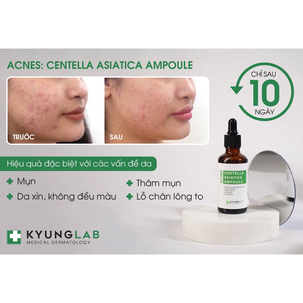 Tinh chất KYUNGLAB CENTELLA ASIATICA ENERGY AMPOULE giảm mụn, ngừa mụn, căng bóng