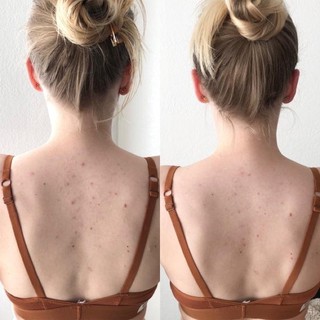 ( hàng chuẩn usa) sữa tắm cho lưng bị mụn SỮA TẮM A.H.A Botanical Body Soap