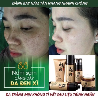 BỘ Kem nám và chống tàn nhang thảo dược SIÊU ĐỈNH TRẮNG TÂY THI trắng sáng và dưỡng ẩm - Hiệu quả chỉ 28 ngày sử dụng