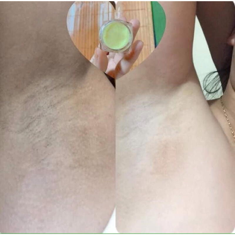 Combo 3 hộp kem khử hôi nách - thâm nách Cô Bơ trắng sáng vùng nách hết mùi hôi hủ 8gr