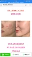 NƯỚC HOA HỒNG SOME BY MI HỖ TRỢ MỤN TÁI TẠO DA AHA - BHA - PHA