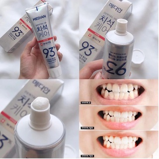 Kem đánh răng Median Dental IQ 93% White Hàn Quốc