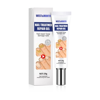 Thuốc Mỡ ALIENBENSON] Phương Tây & Tháng Loại Bỏ Nấm Móng Tay Và Móng Chân Và Tẩy Sơn Móng