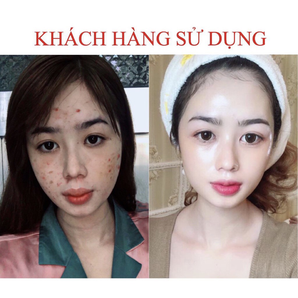 Ảnh Serum giảm mụn thâm Seimy - Skin 7 Days Plus 10ml 4