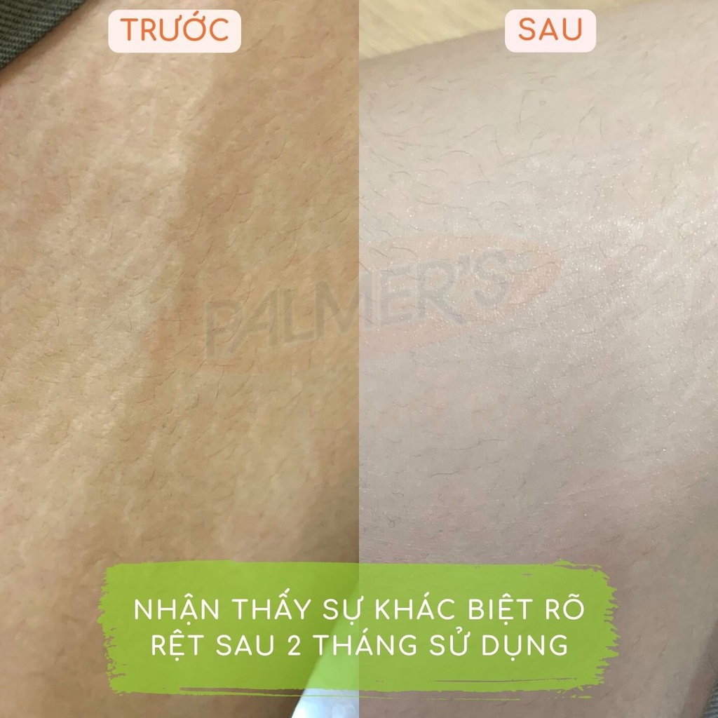 Ảnh Kem ngăn ngừa và phục hồi rạn da giữa thai kỳ Palmer's 125g 3