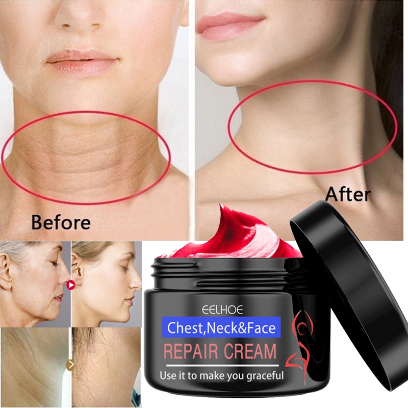 Kem Dưỡng Ẩm Làm Trắng Da Mặt Và Cổ Chống Lão Hóa 30g
