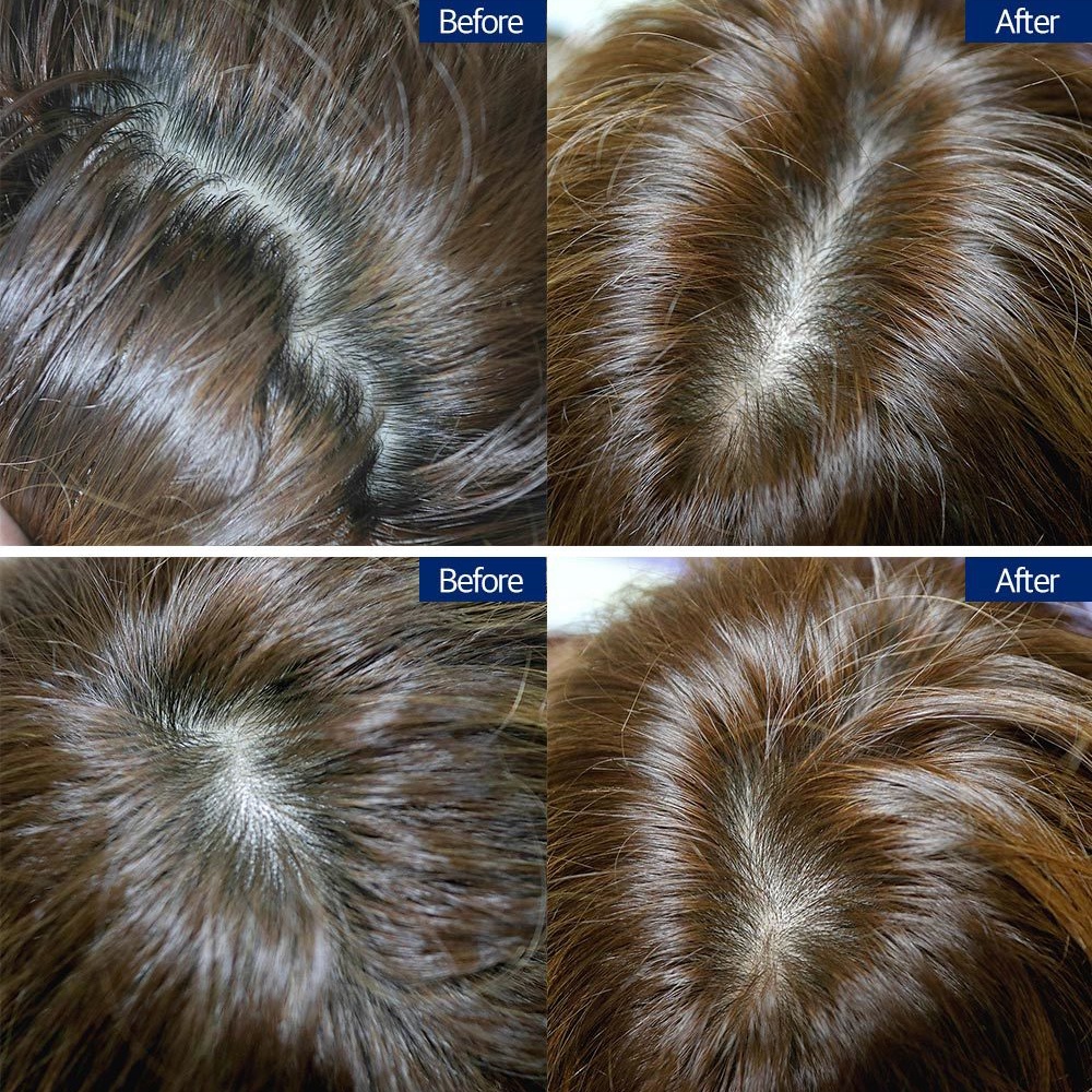 [COSNORI] Dầu gội Grow Anti-Hairloss Pro-vit B5