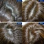 Dầu gội Grow Anti-Hairloss Pro-vit B5