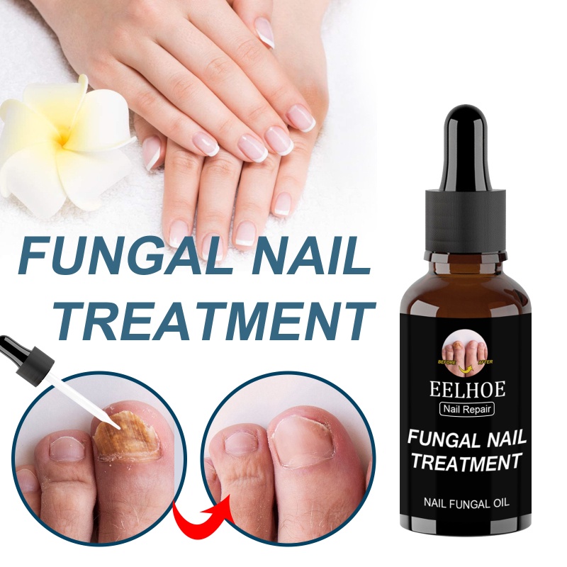 Ảnh Tinh chất phục hồi móng EELHOE ANNIES 30ml/ 50ml loại bỏ nấm chăm sóc móng tay móng chân 1