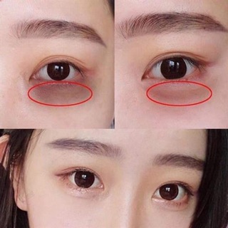 Kem Dưỡng Mắt Meishoku Whitening Eye Cream