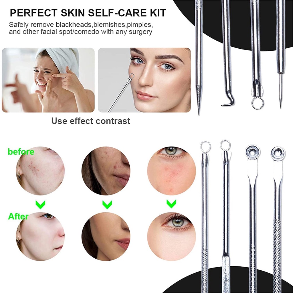 Set 4 Dụng Cụ Loại Bỏ Mụn Đầu Đen Chăm Sóc Da Mặt Tiện Dụng