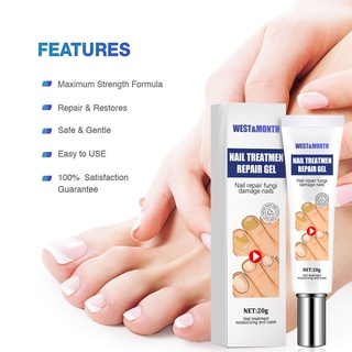 Thuốc Mỡ ALIENBENSON] Phương Tây & Tháng Loại Bỏ Nấm Móng Tay Và Móng Chân Và Tẩy Sơn Móng