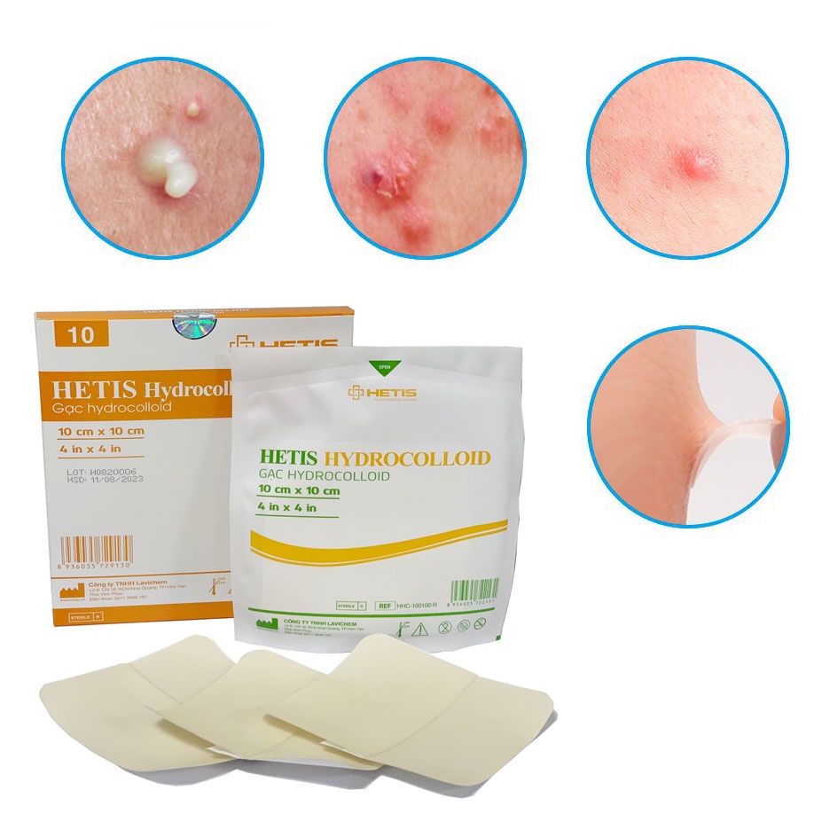 Mô tả Miếng Dán Mụn, Vết Thương ALFASEPT HETIS HYDROCOLLOID Giúp Thấm hút Dịch, Loại Bỏ Những Mô Chết, Ngăn Ngừa Sẹo - 5