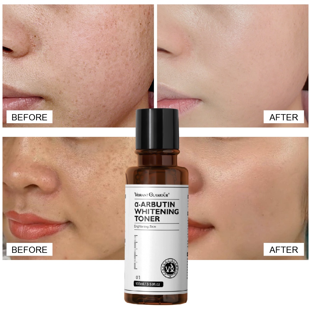 Ảnh Toner α-Arbutin VIBRANT GLAMOUR làm trắng, giảm thâm, tàn nhang và dưỡng ẩm cho da mặt 100ml 3