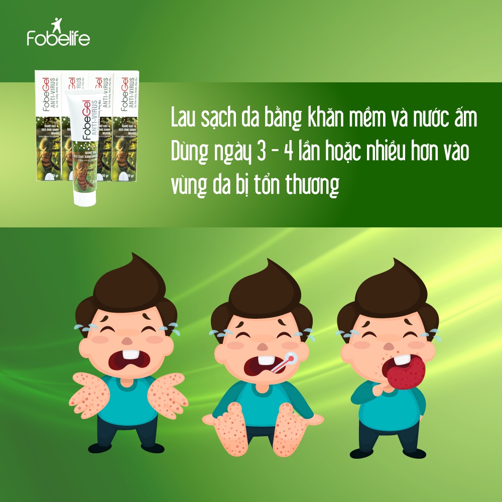 Gel Tái Tạo Anti Virus Fobe Hỗ Trợ Làm Lành Da Do Virus Gây Nên, Thủy Đậu N1