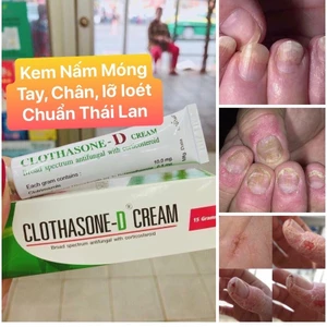 KEM DƯỠNG NẤM DA TAY THÁI LAN [SẴN][FREESHIP][CHUẨN HÀNG][BẢO HÀNH 7 NGÀY]